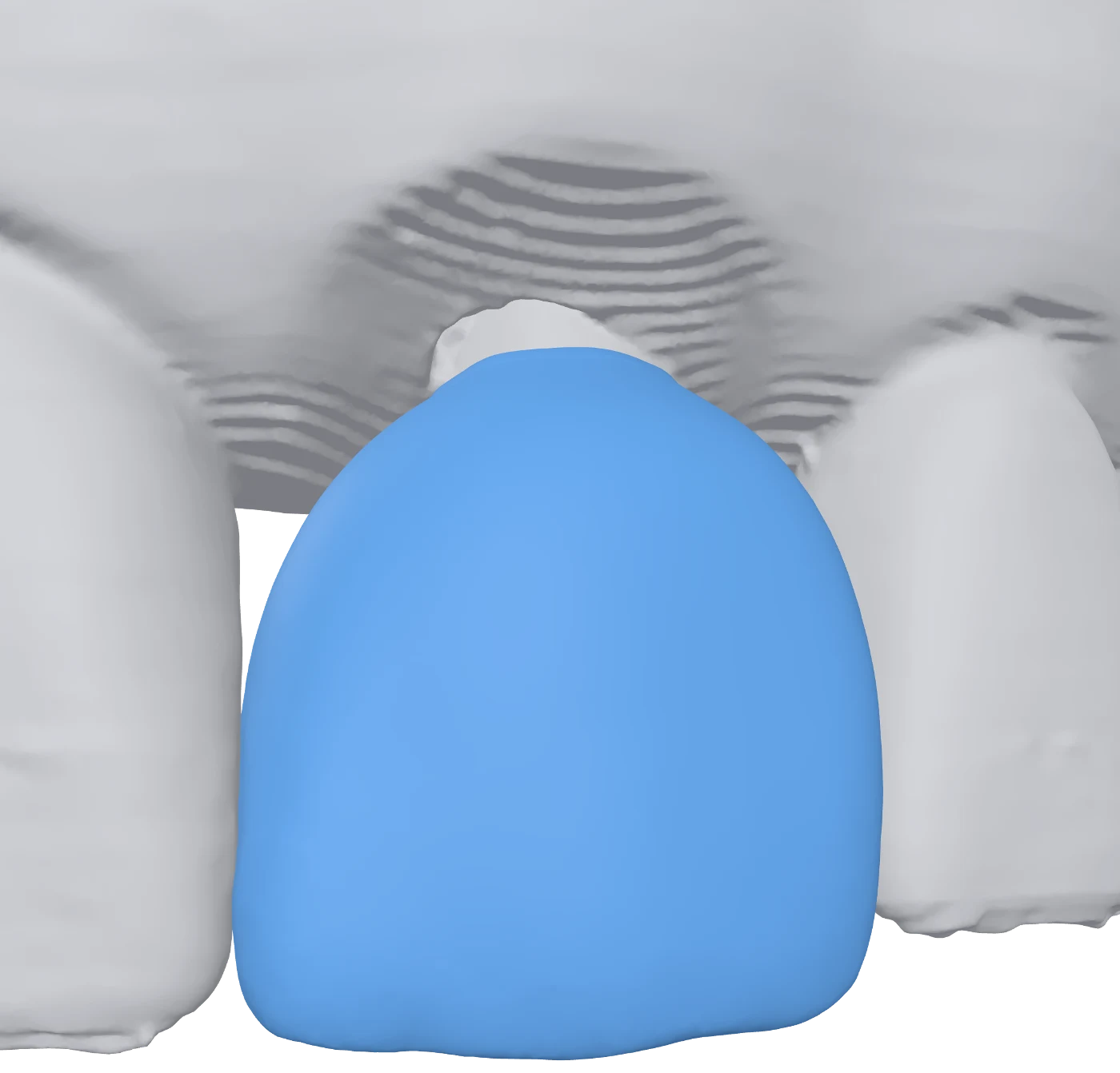 Ein blau eingefärbter Scan sitzt zwischen den grauen Nachbarflächen